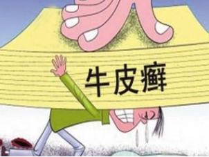 治疗牛皮癣的医院